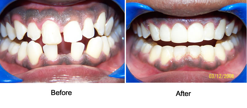 Orthodontic Cases