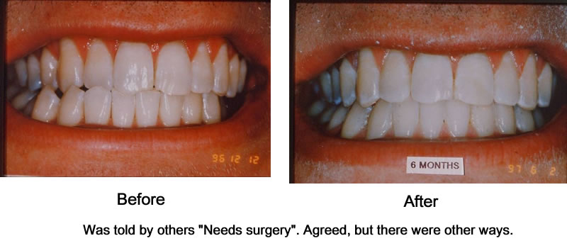 Orthodontic Cases