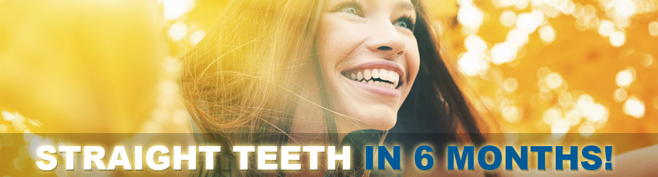 Straight Teeth in 6 Months