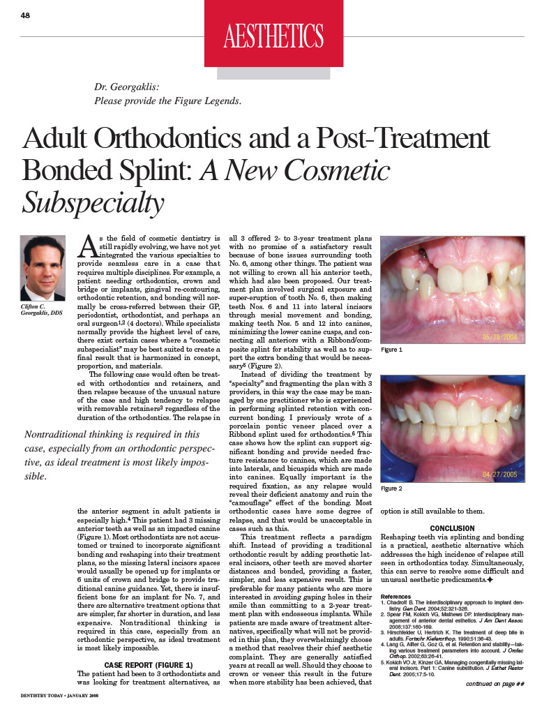 brookline invisible braces