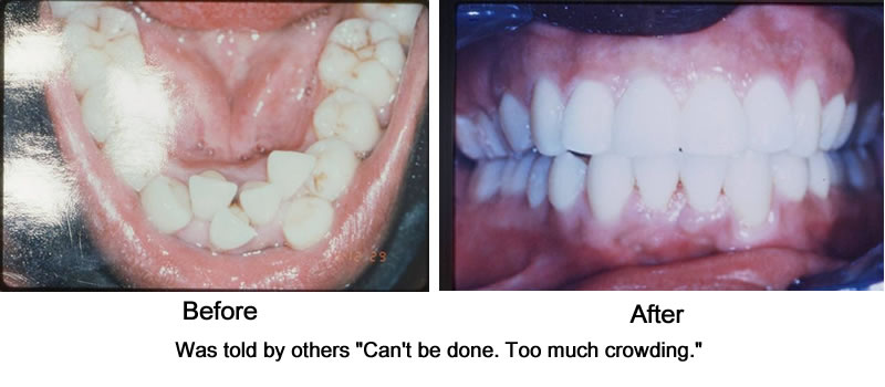 Orthodontic Cases