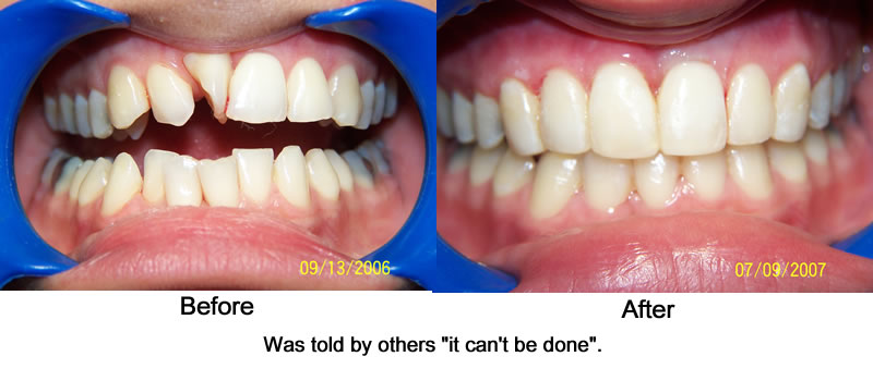 Orthodontic Cases