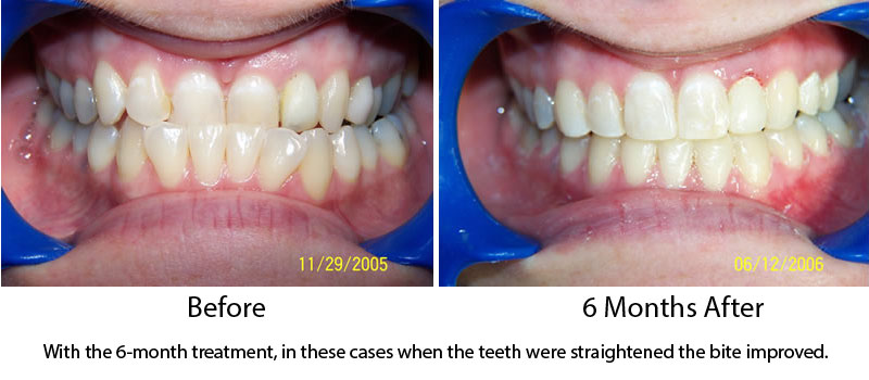 boston orthodontist treatment